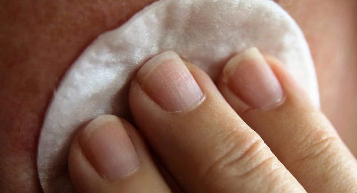  Kako smanjiti otok od bubuljice prirodnim putem?