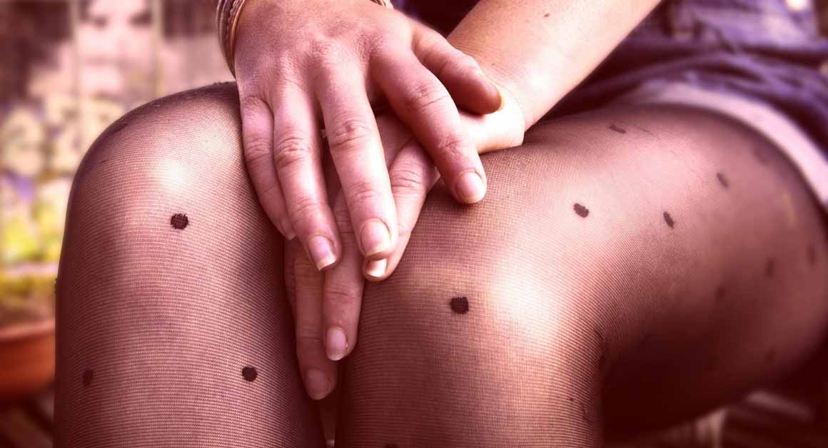  Lečenje vena kupusom: da li to zaista i radi?