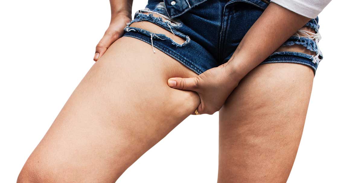  Anticelulit dijeta: priručnik za glatku kožu