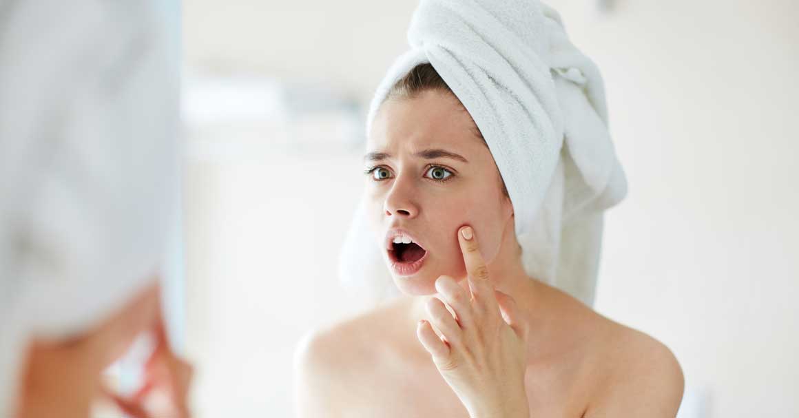  Medicinski alkohol za bubuljice?Da ili ne?