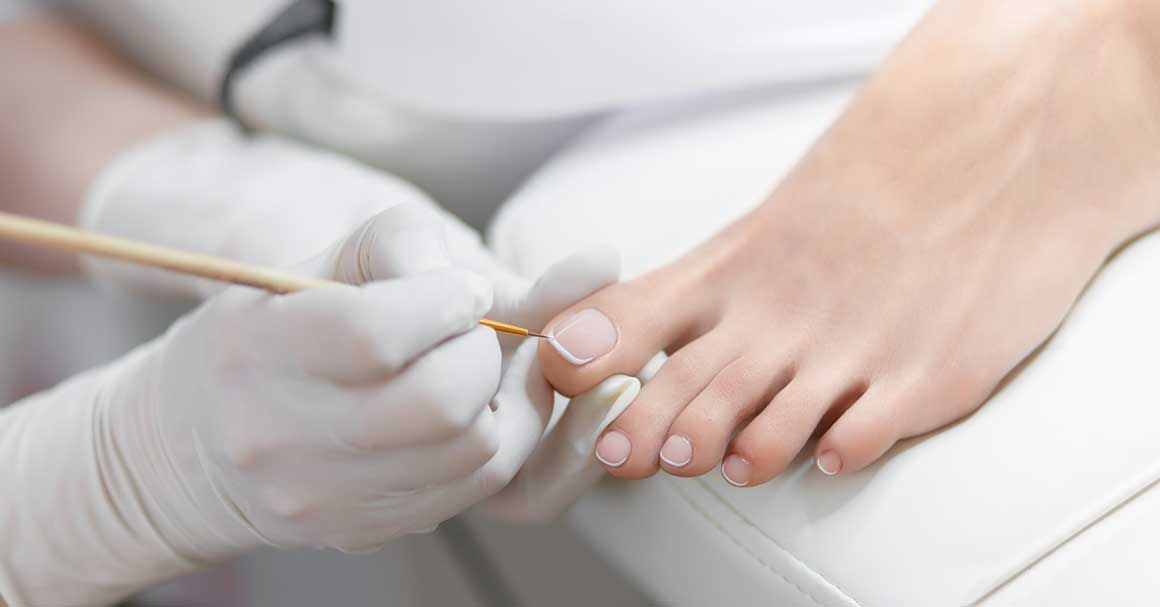 olovka za gljivice na noktima