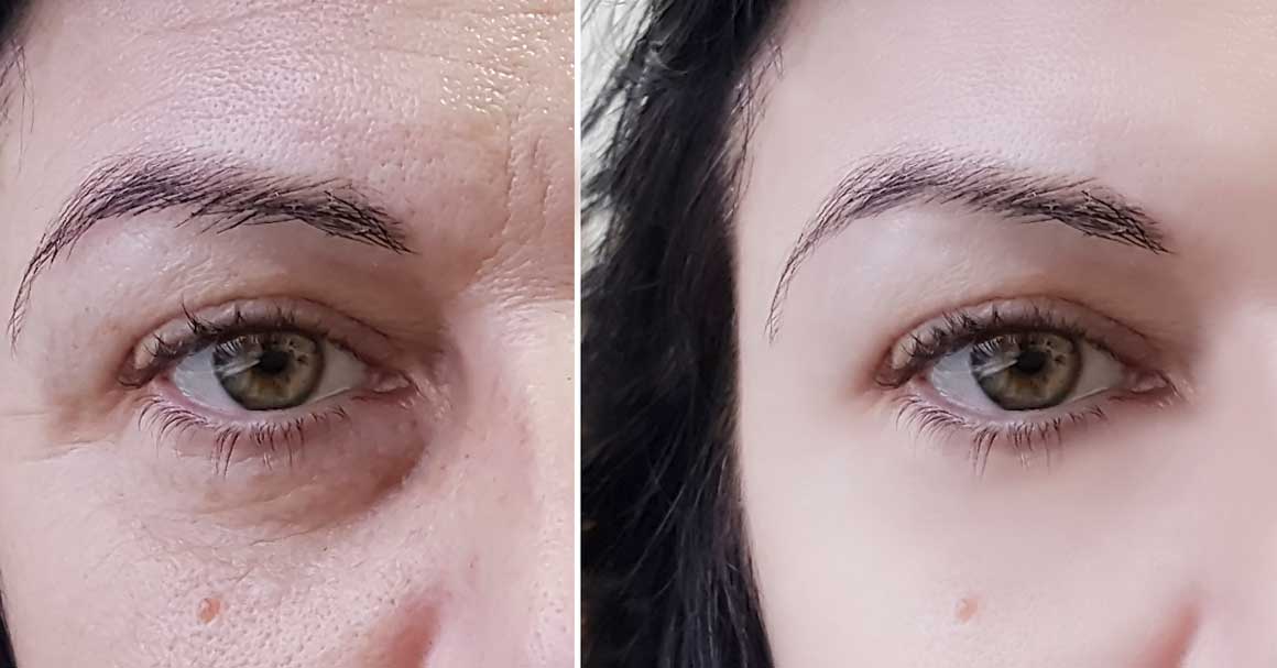  Krema za podočnjake: ultimativna lista najboljih