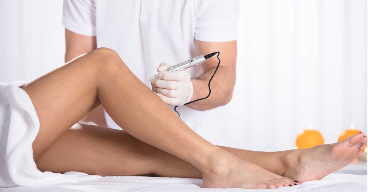  Mezoterapija celulita: kokteli koji brišu masne naslage
