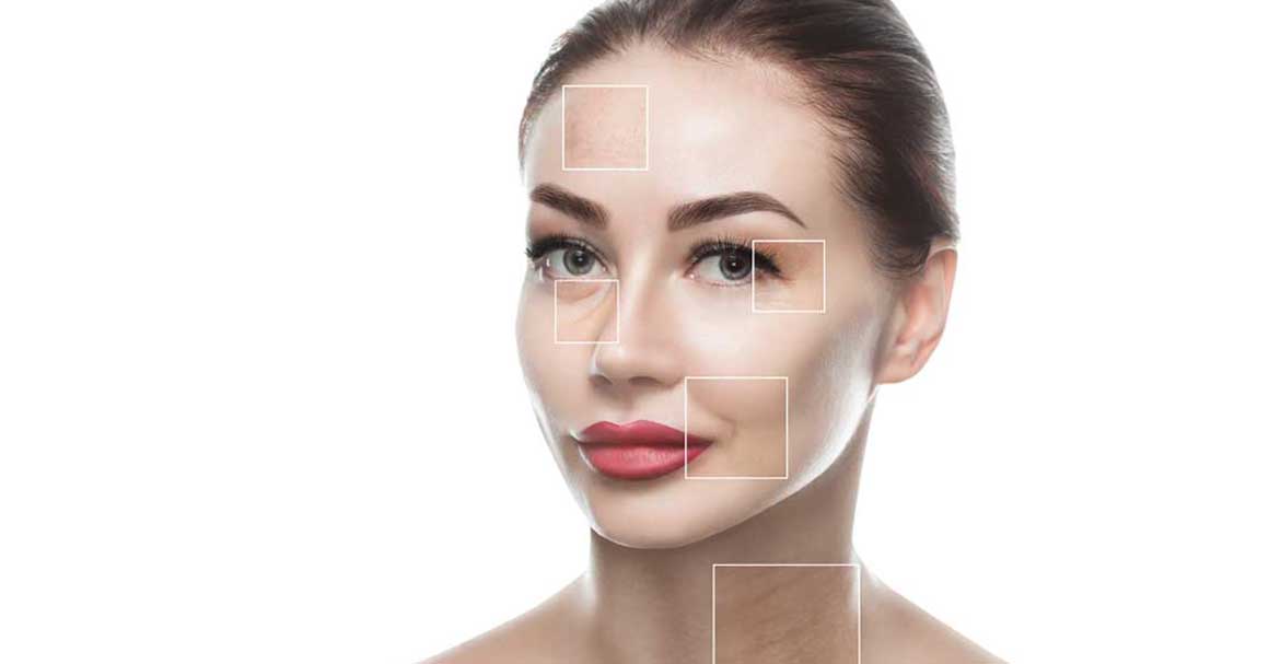  Otkrij šta su bore i kako zapravo nastaju!