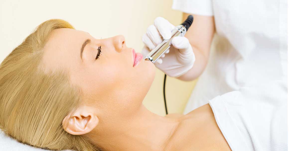  Mikrodermoabrazija: šta je, cena i iskustva!