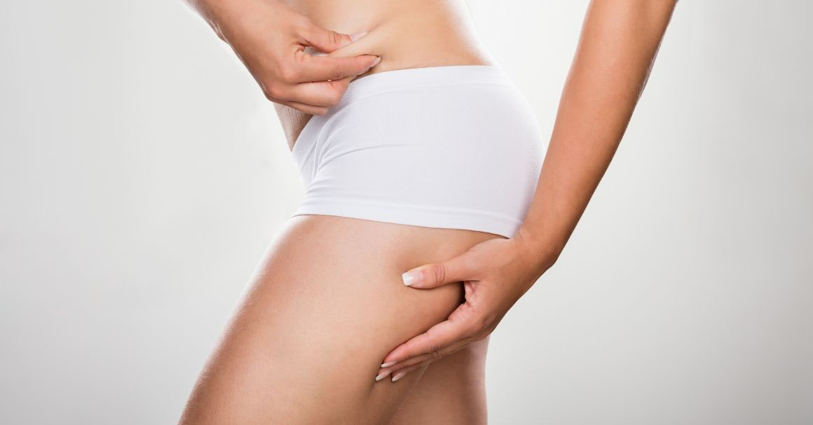 kako skinuti celulit za 7 dana