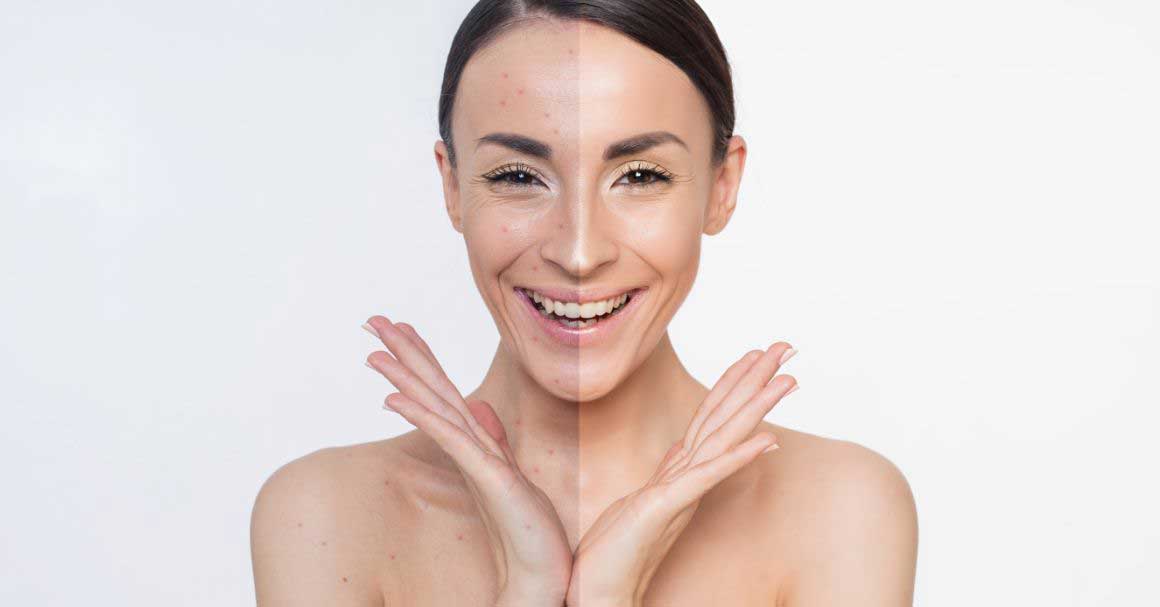 bubuljice od šminke