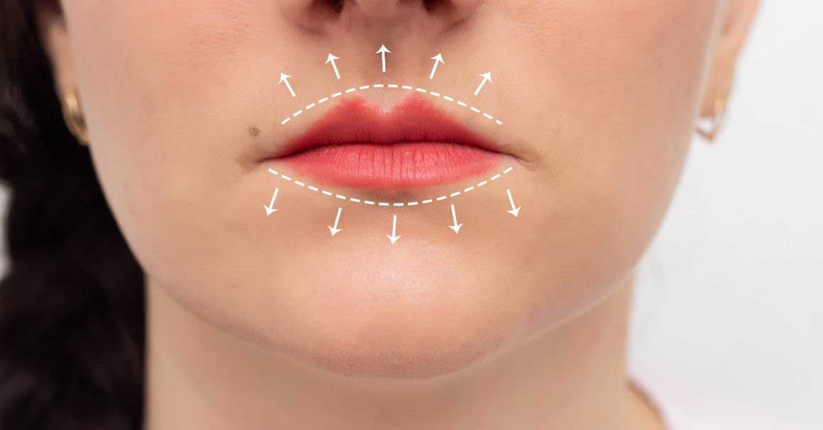  Bore oko usana? Ne hvala! Evo rešenja!