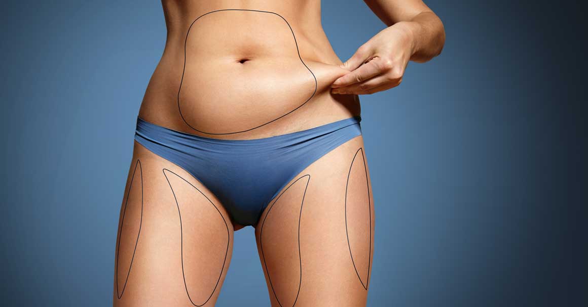  Liposukcijska ishrana – režim koji će ti promeniti život!