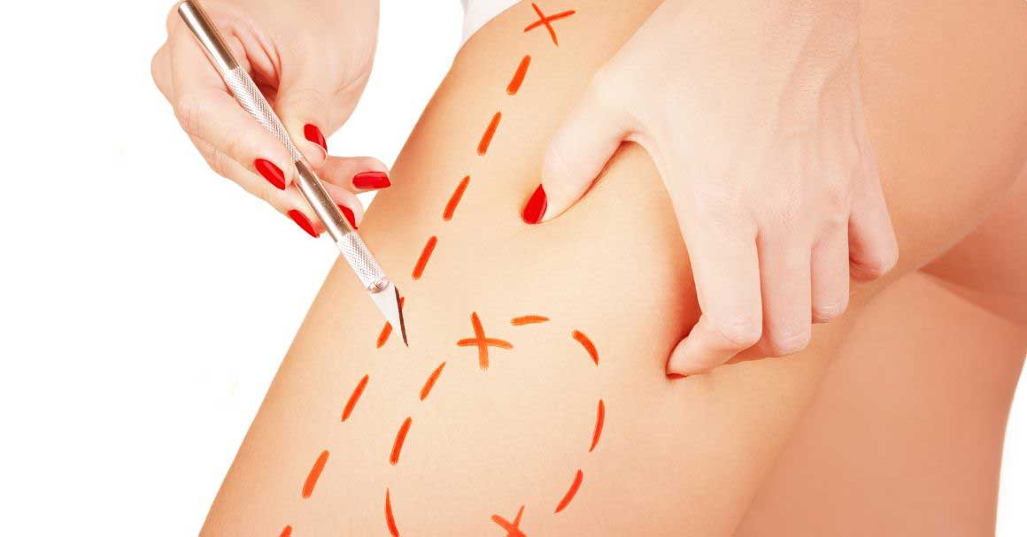  Kako crno vino skida celulit?