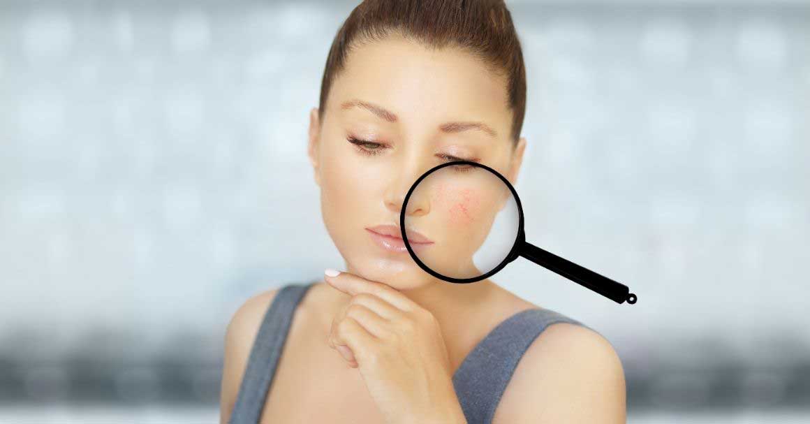  Zašto je čuvarkuća za fleke na licu tako moćna?