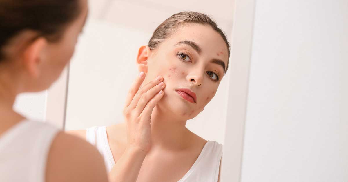  Prepoznaj čir na koži i reši ga se!