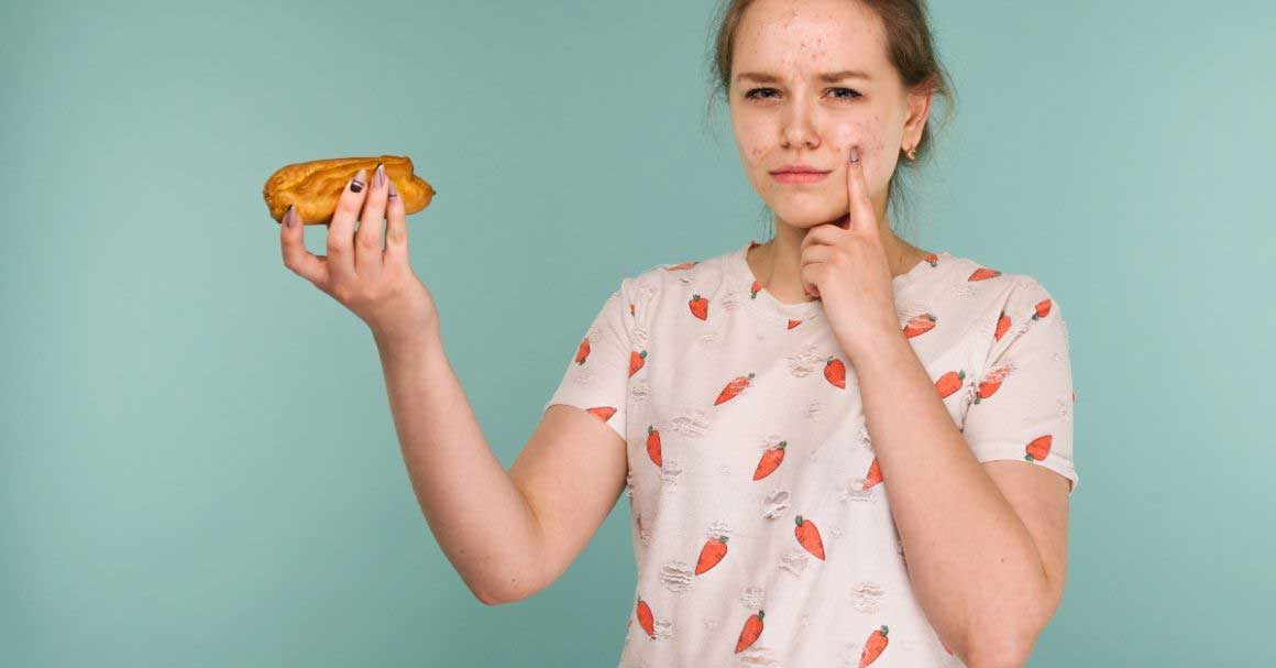  Koja hrana izaziva bubuljice? Otkrijte!