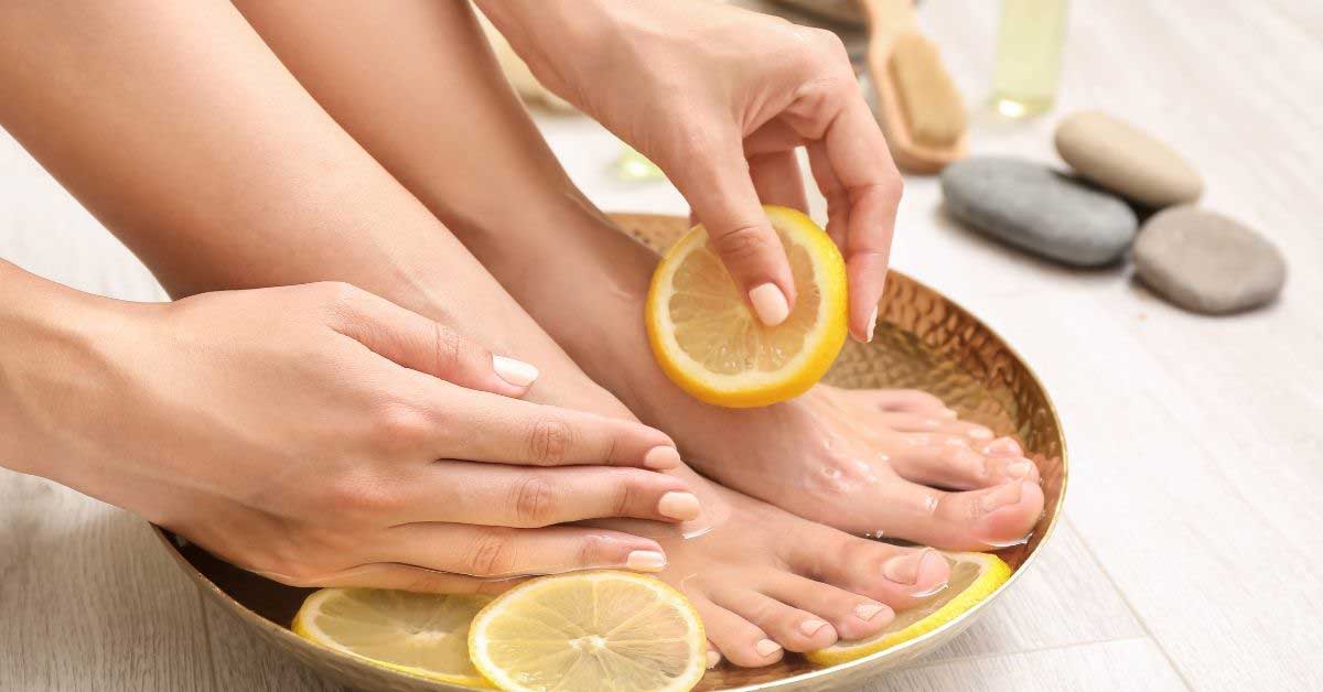  Limun za pete! SOS rešenje za ispucalu kožu!