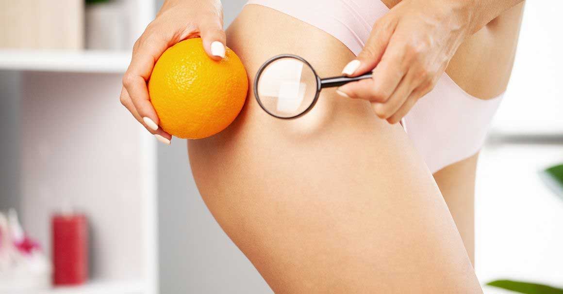  Kako se koriste biljke protiv celulita?