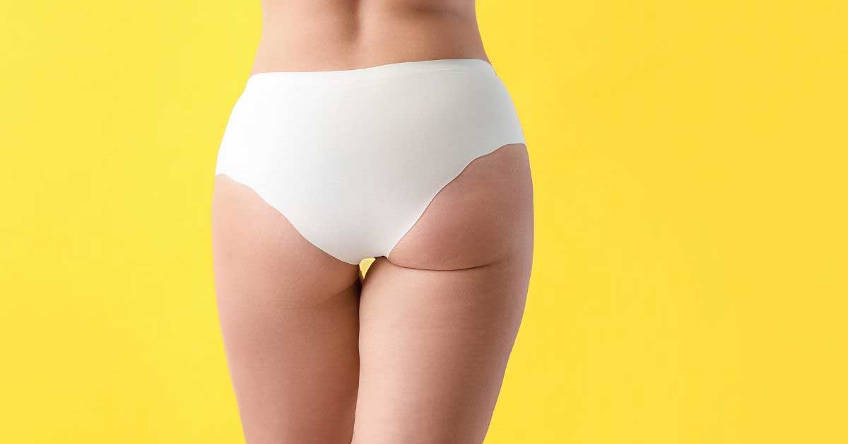  Saznaj kako se dobija celulit. Iznenadićeš se!