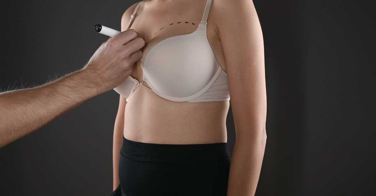  Vampirsko podizanje grudi! O čemu je reč?