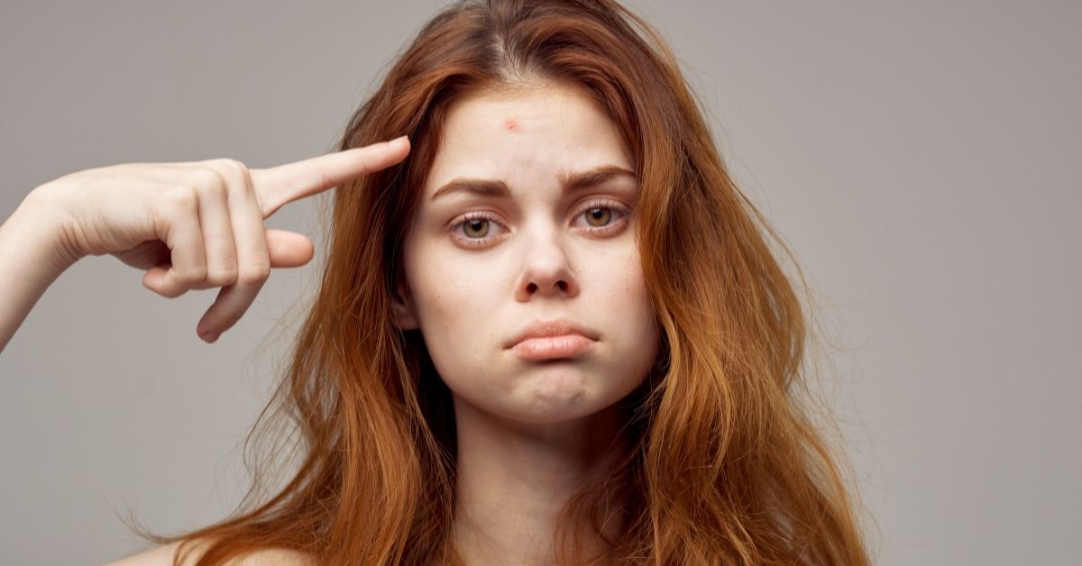  Bubuljice kod odraslih – reši odmah problem!