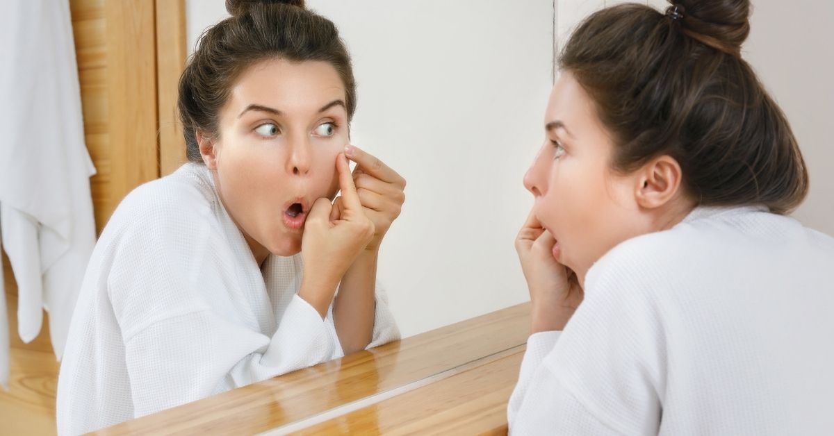 bubuljice u tridesetim godinama