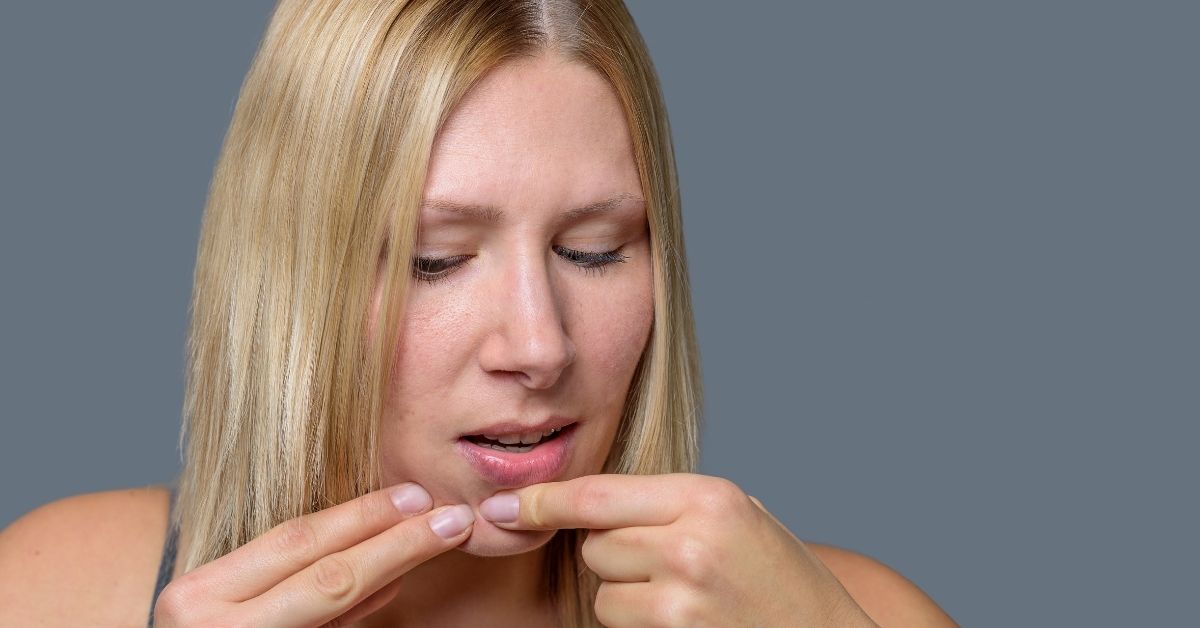  Bubuljice na bradi! Kako ih se najbrže rešiti?