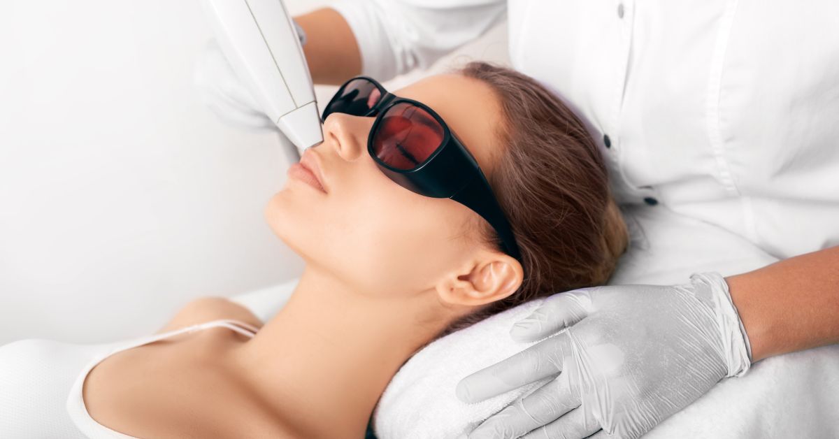  Nova mogućnost: uklanjanje akni laserom!