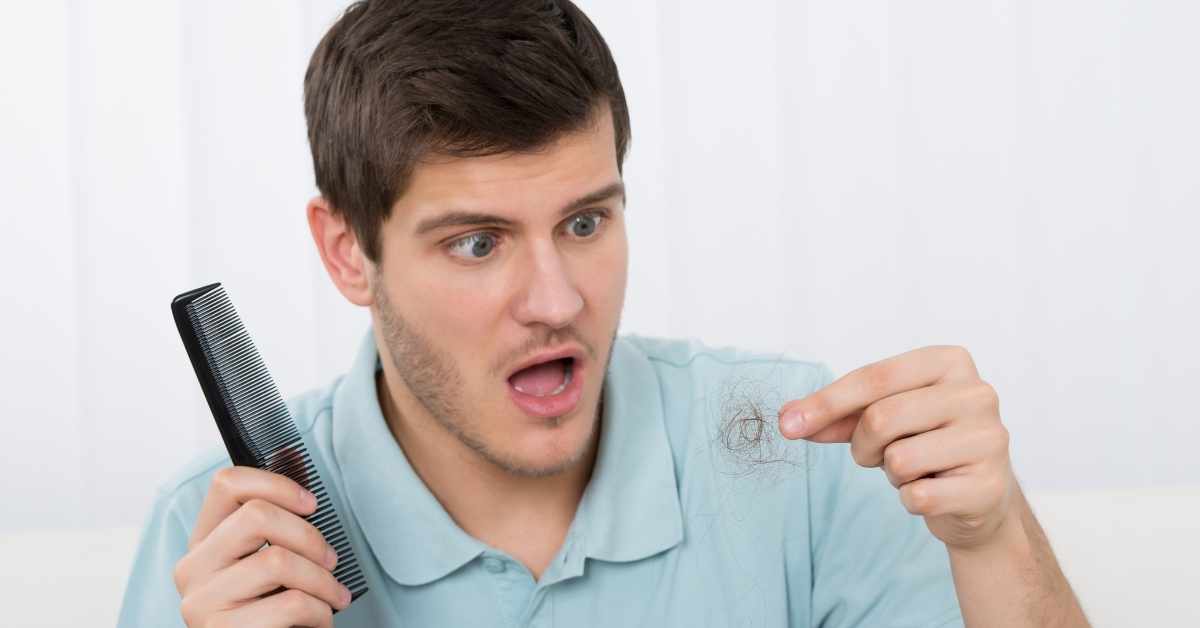 opadanje kose kod muškaraca