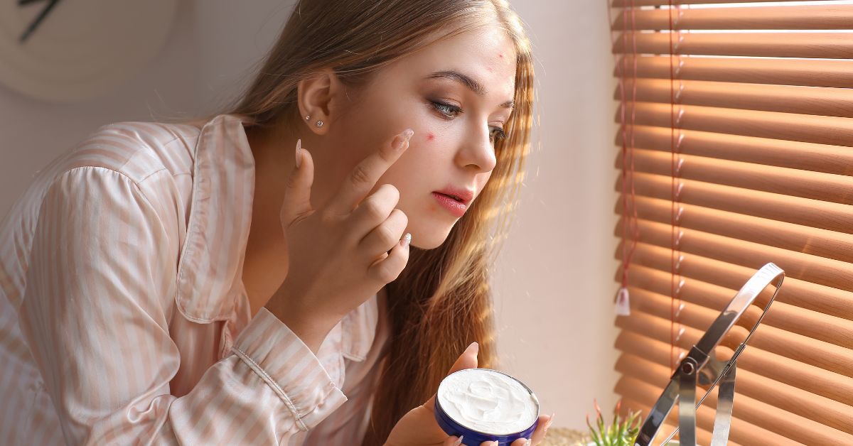  Krema za ožiljke od akni: koju ćeš izabrati?