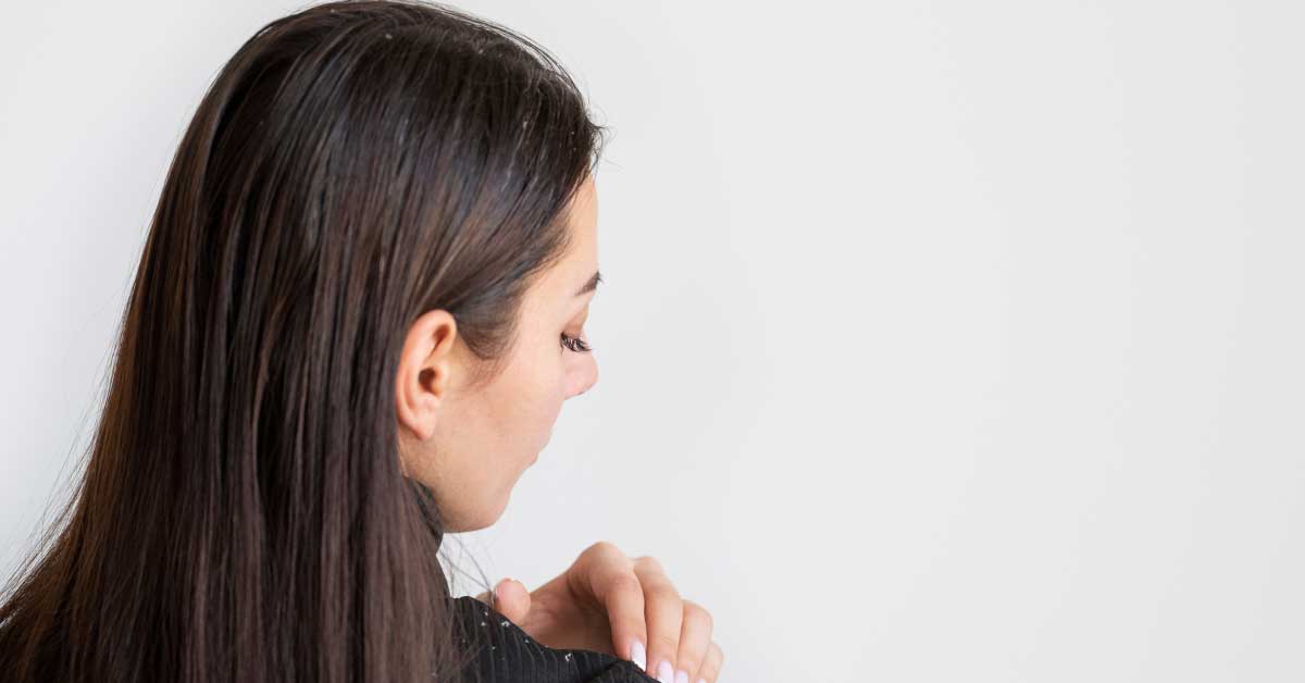  Otkrivamo: kako se rešiti peruti, brzo i efikasno!