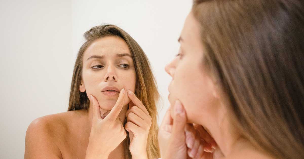  Kako očistiti lice od mitisera? Ovo je spas!