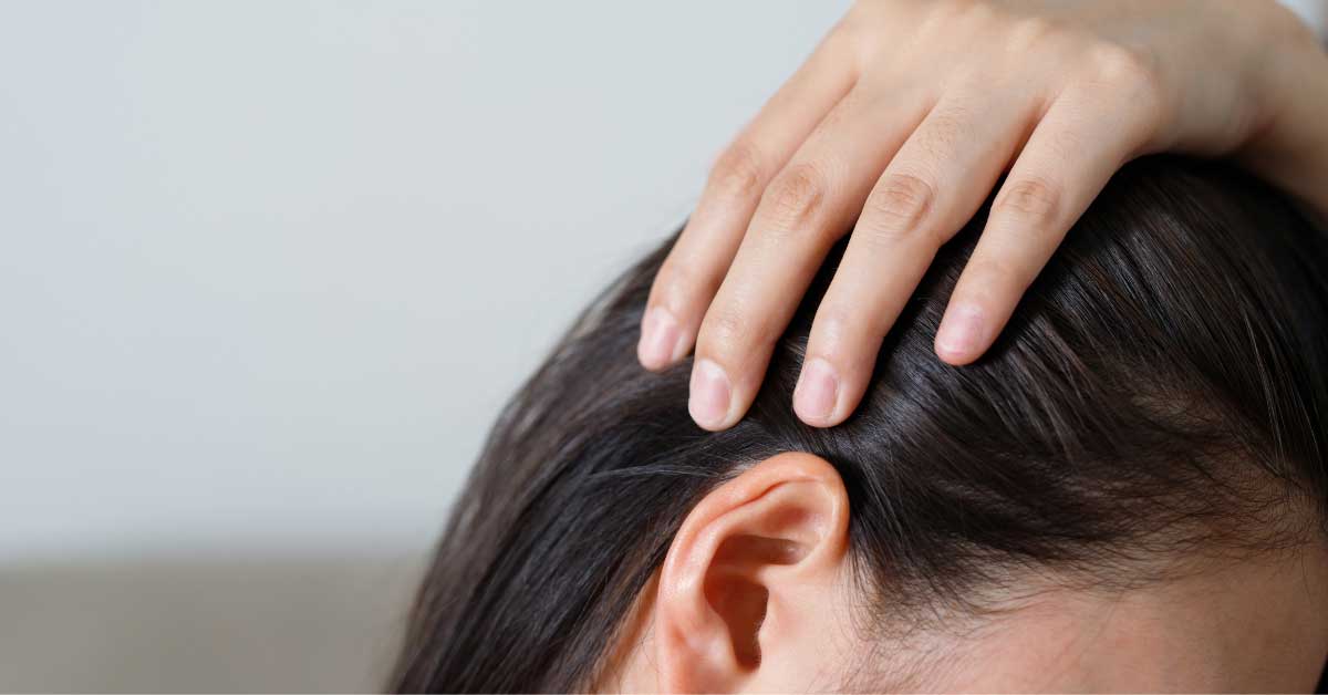 šampon za seboreični dermatitis