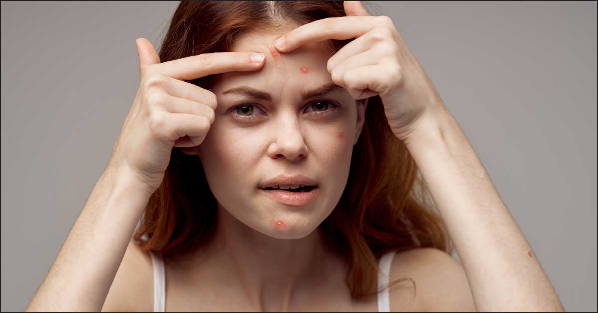  Bubuljice na čelu? Ne, nije samo do masne kože!