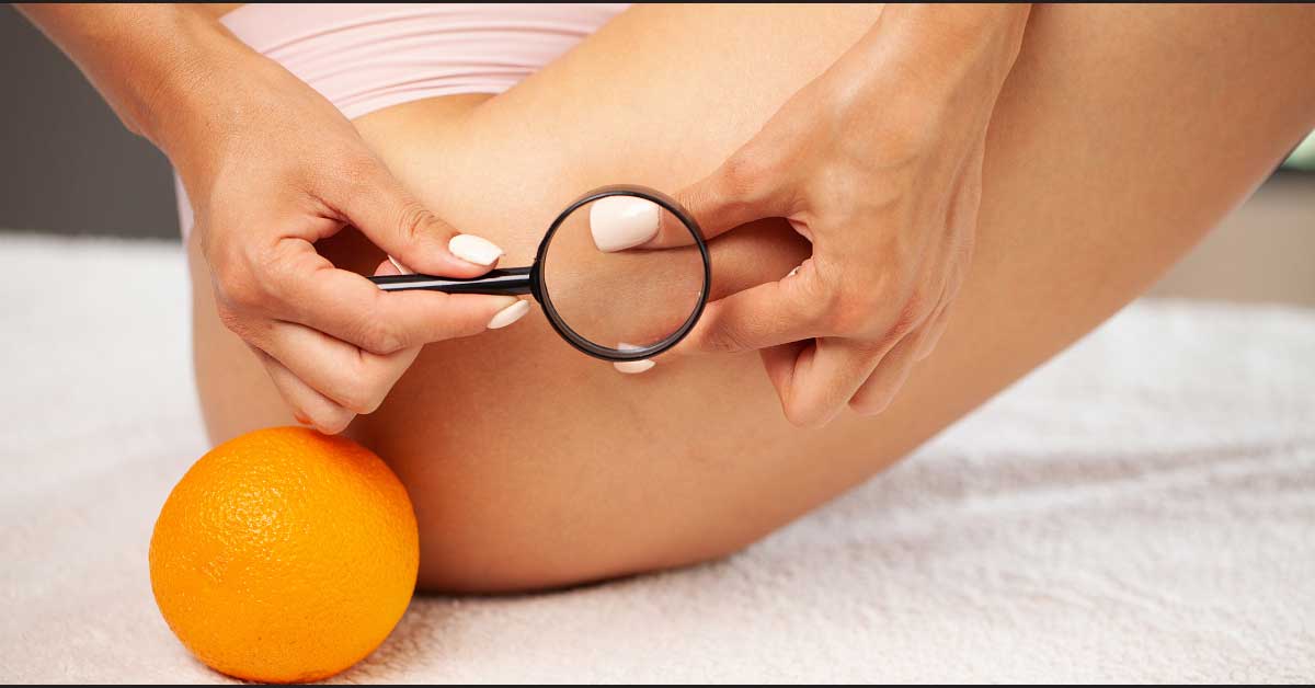  PROVERENO! Ove metode brišu CELULIT NA NOGAMA!